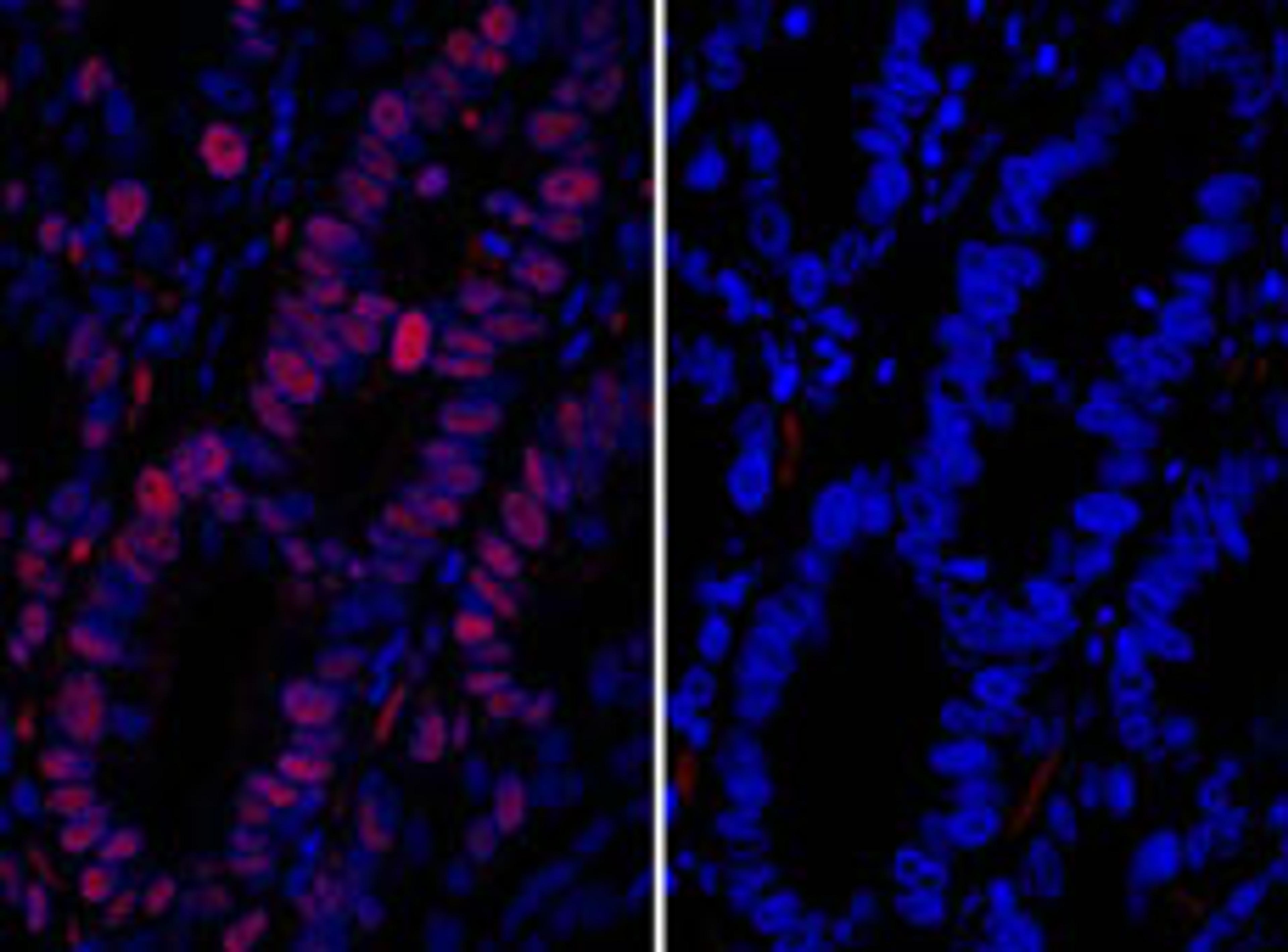 Detection of human MCM3 by immunofluorescence.