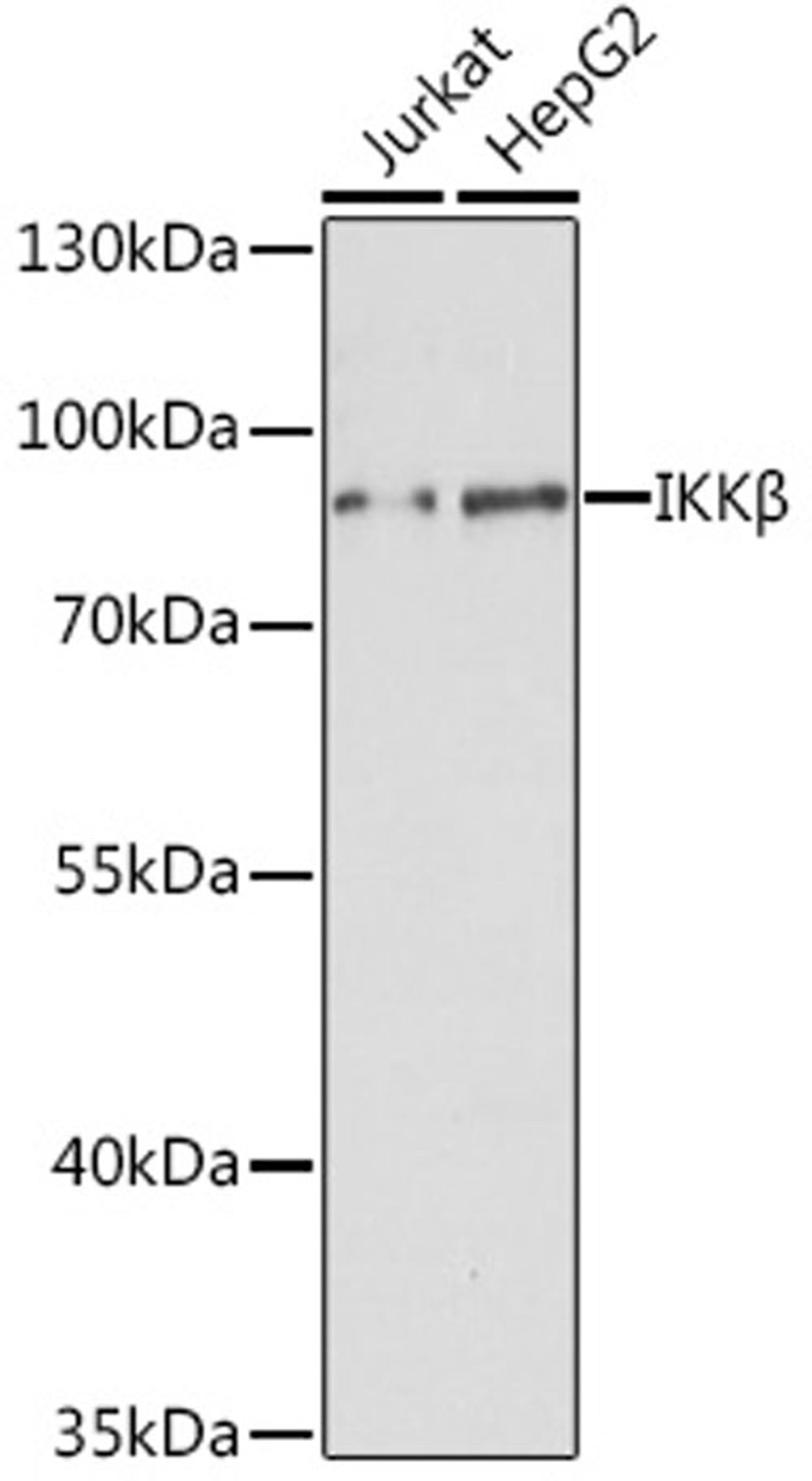 Western blot - IKKß antibody (A0714)