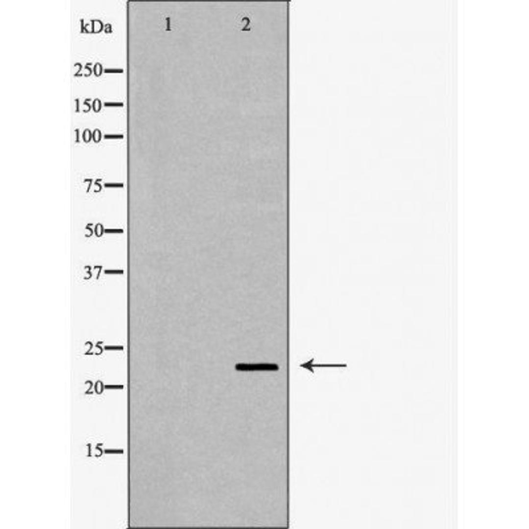 Western blot analysis of mouse eye using CRYBB2 antibody