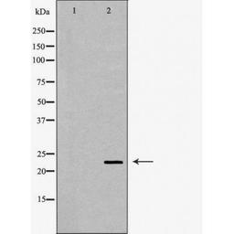 Western blot analysis of mouse eye using CRYBB2 antibody