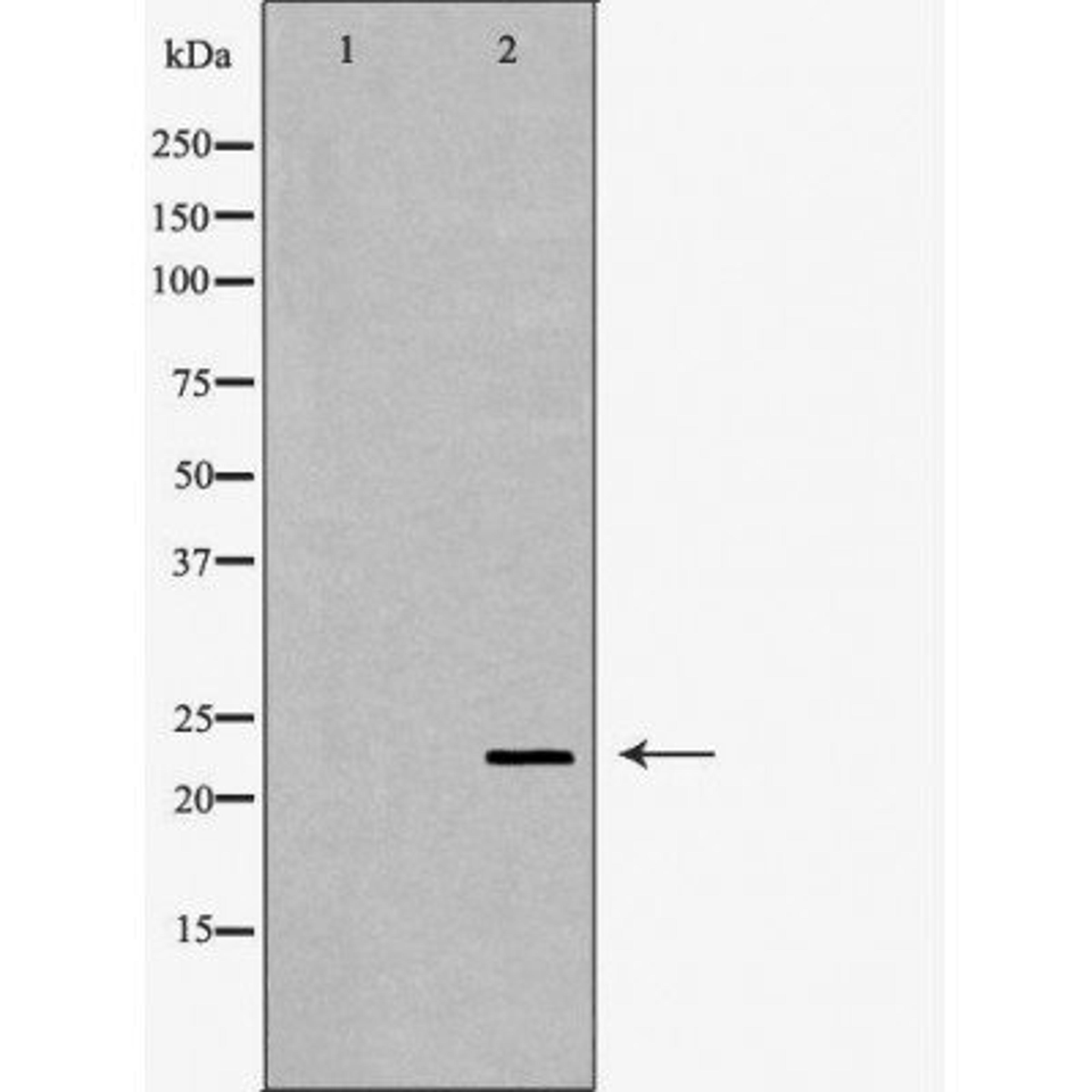 Western blot analysis of mouse eye using CRYBB2 antibody