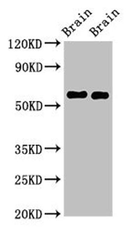 Western Blot. Positive WB detected in: Mouse brain tissue, Rat brain tissue. All lanes: GAS7 antibody at 2.5ug/ml. Secondary. Goat polyclonal to rabbit IgG at 1/50000 dilution. Predicted band size: 55, 48, 40 kDa. Observed band size: 55 kDa. 