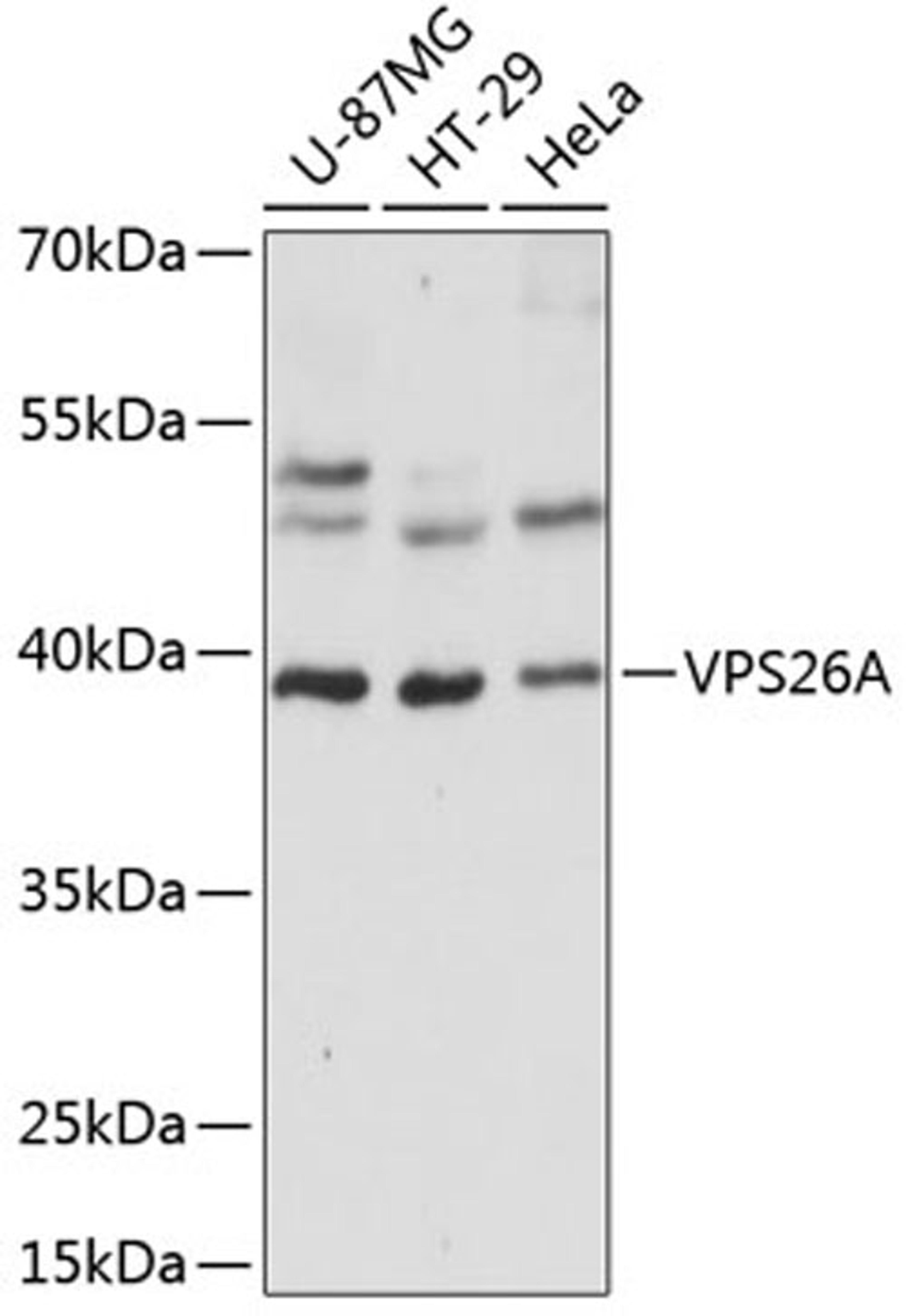 Western blot - VPS26A antibody (A14265)