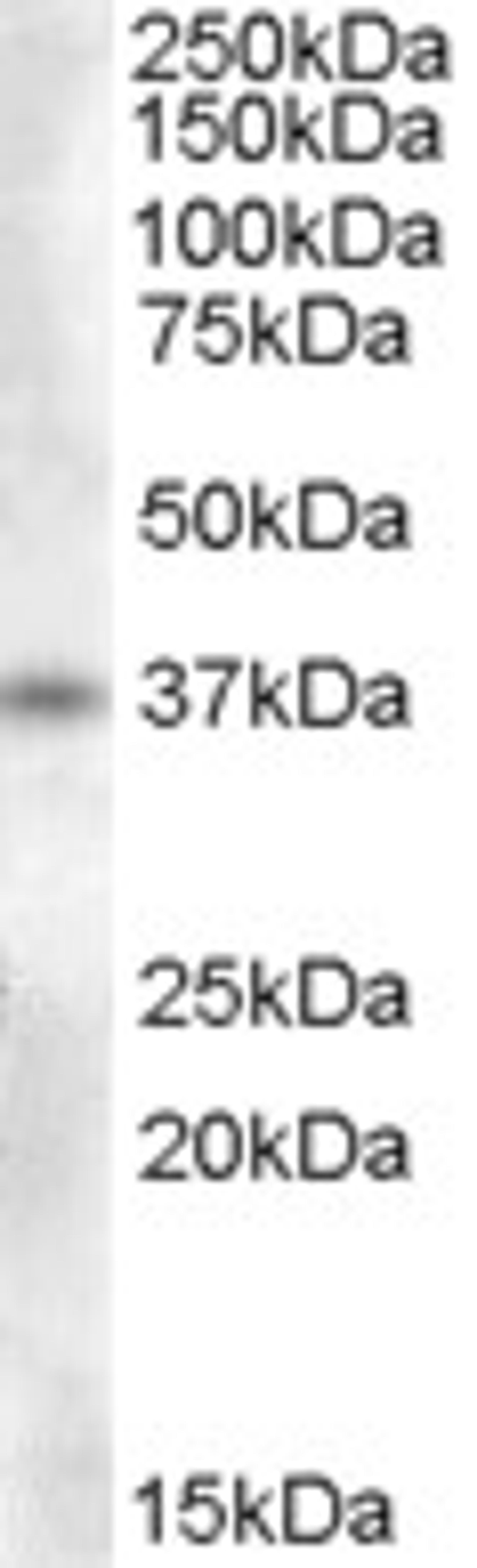 46-227 (0.3ug/ml) staining of Human Adrenal Gland lysate (35ug protein in RIPA buffer). Primary incubation was 1 hour. Detected by chemiluminescence.