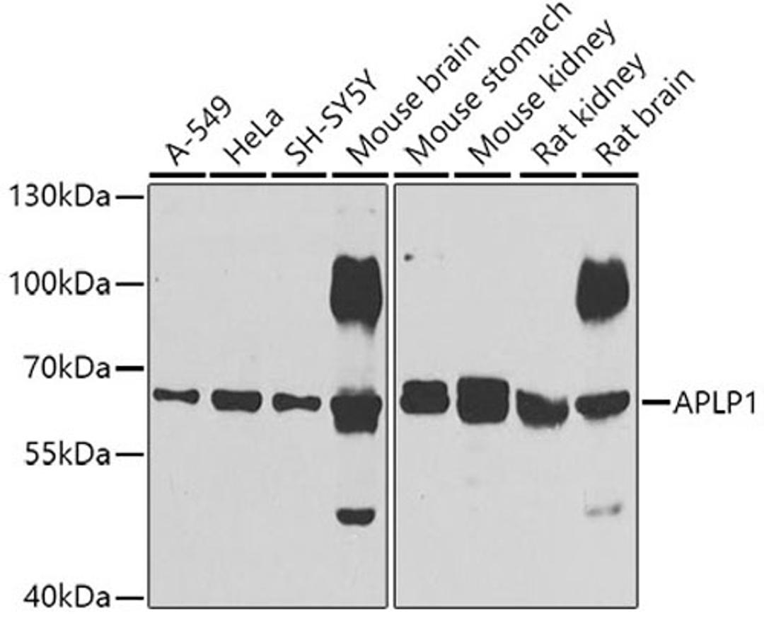 Western blot - APLP1 antibody (A6870)