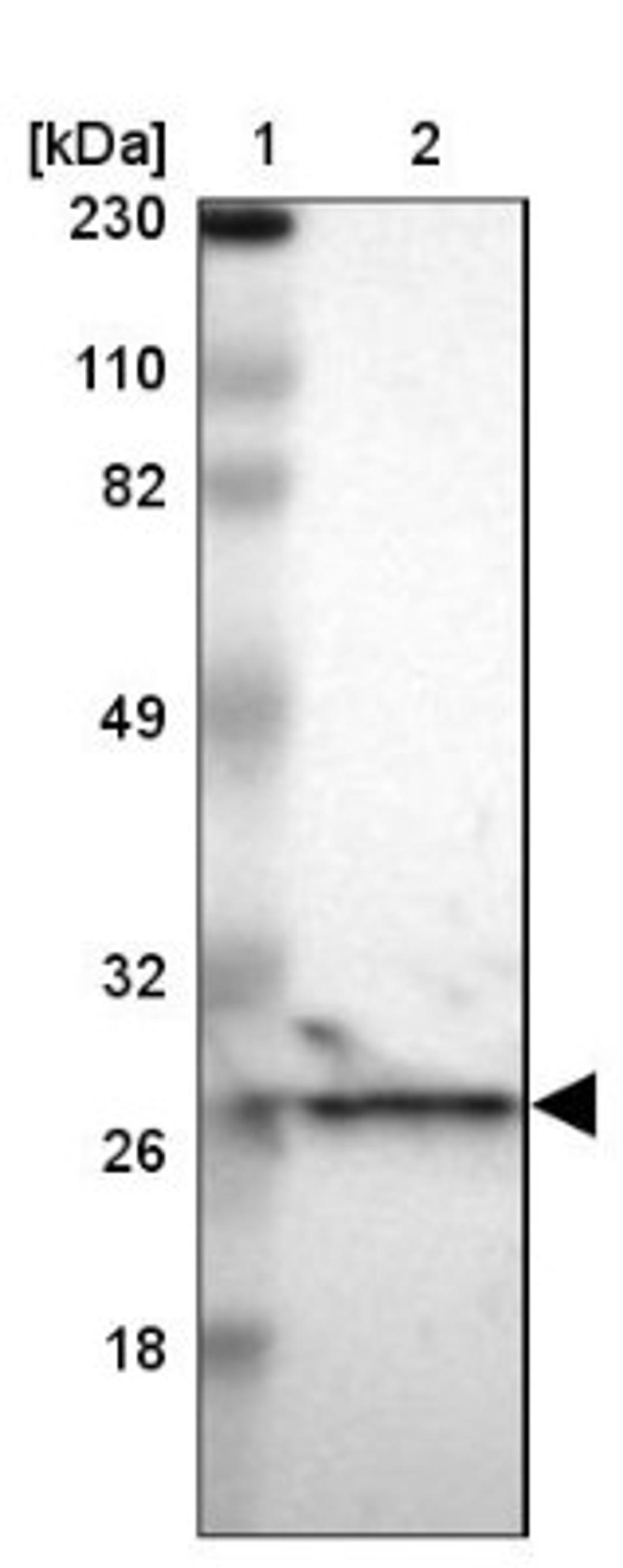 Western Blot: PCMT1 Antibody [NBP1-85806] - Lane 1: Marker [kDa] 230, 110, 82, 49, 32, 26, 18<br/>Lane 2: Human cell line RT-4