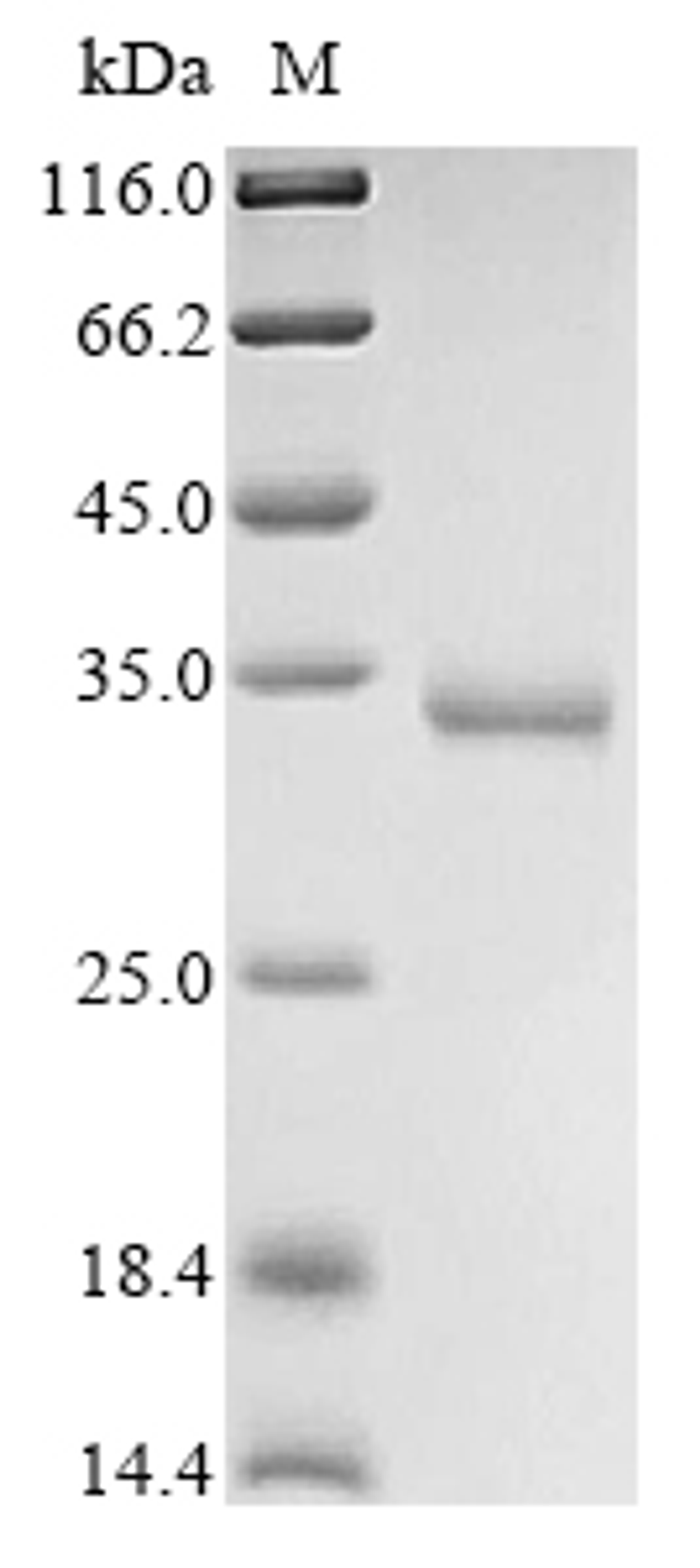(Tris-Glycine gel) Discontinuous SDS-PAGE (reduced) with 5% enrichment gel and 15% separation gel.