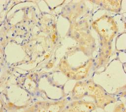 Immunohistochemistry of paraffin-embedded human kidney tissue using CSB-PA668210LA01HU at dilution of 1:100