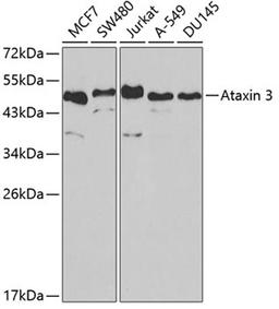 Western blot - Ataxin 3 antibody (A1243)