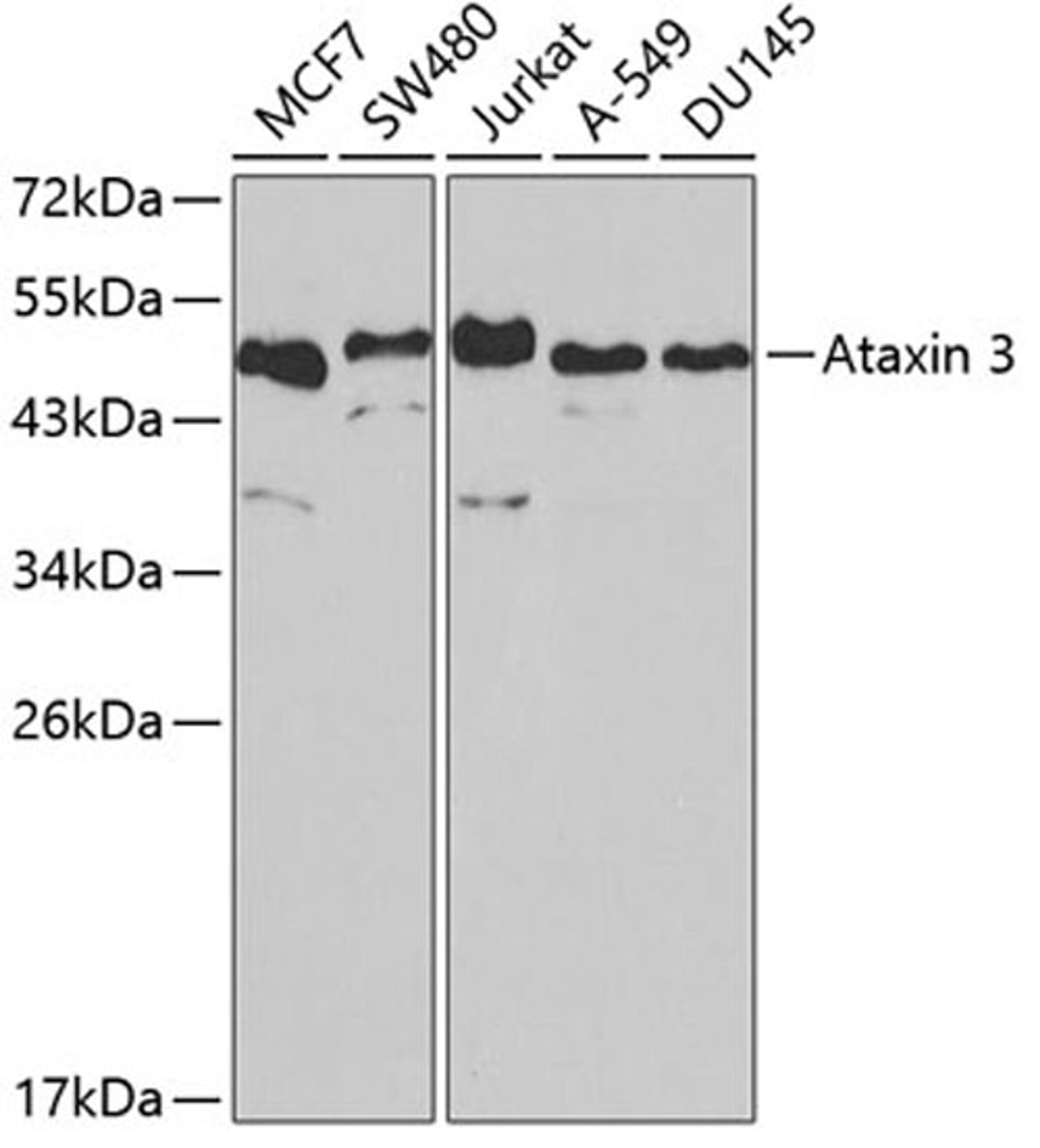 Western blot - Ataxin 3 antibody (A1243)