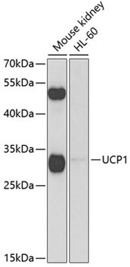 Western blot - UCP1 antibody (A5857)