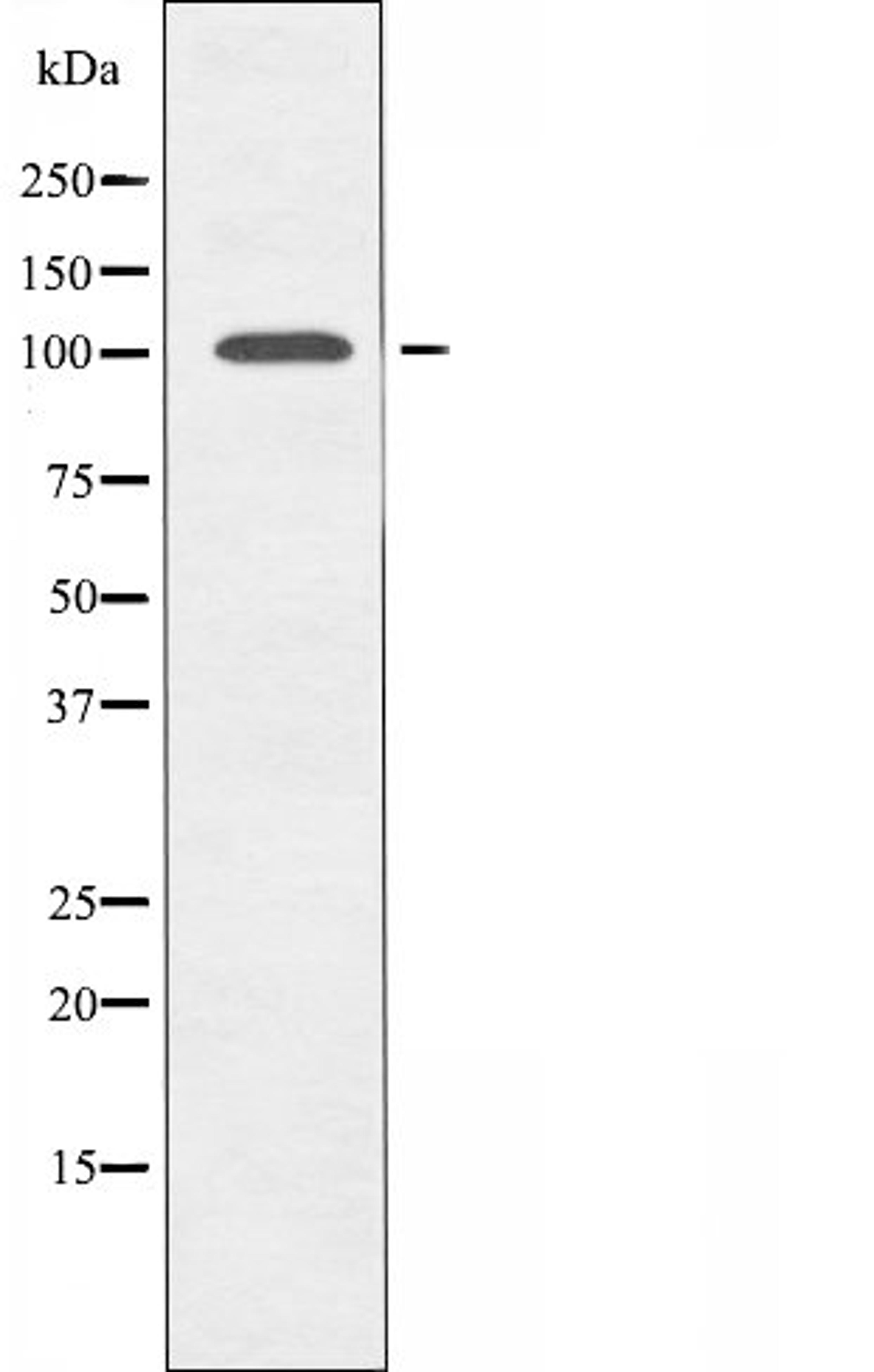 Western blot analysis of mouse brain cells using GCN5L2 antibody