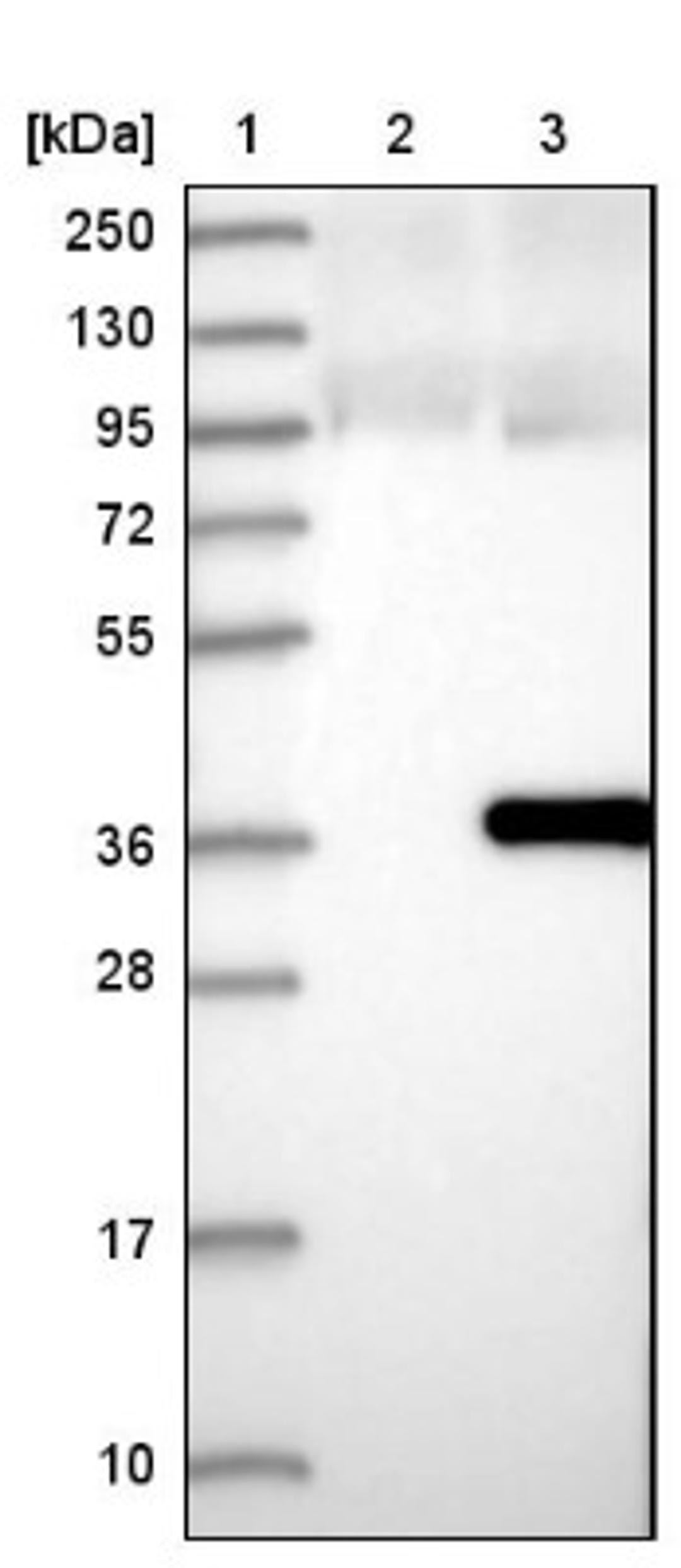 Western Blot: RWDD2A Antibody [NBP1-85167] - Lane 1: Marker [kDa] 250, 130, 95, 72, 55, 36, 28, 17, 10<br/>Lane 2: Negative control (vector only transfected HEK293T lysate)<br/>Lane 3: Over-expression lysate (Co-expressed with a C-terminal myc-DDK tag (~3.1 kDa) in mammalian HEK293T cells, LY409561)