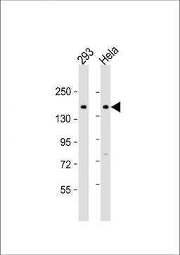 Western Blot at 1:500-1:1000 dilution Lane 1: 293 whole cell lysate Lane 2: Hela whole cell lysate Lysates/proteins at 20 ug per lane.