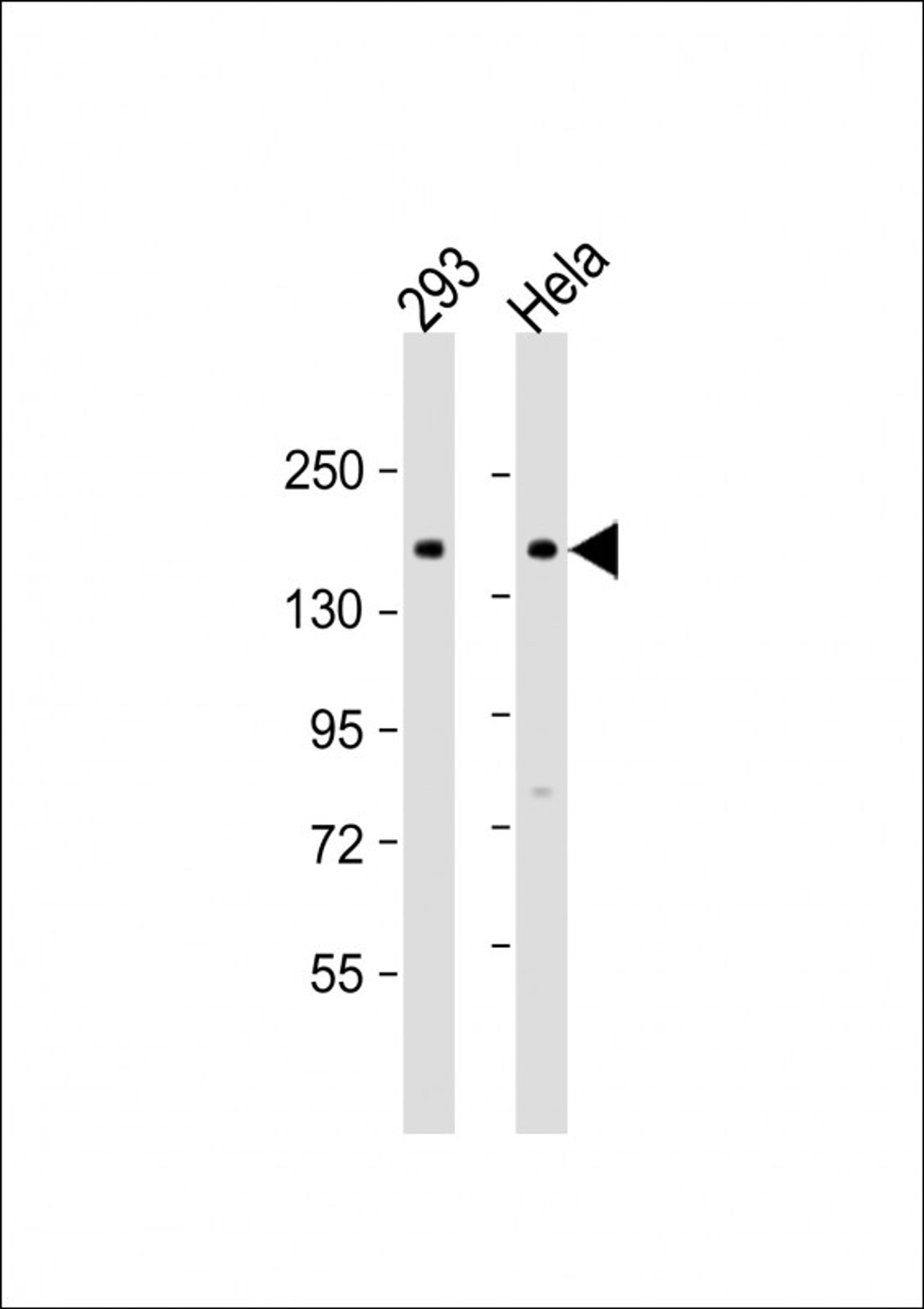 Western Blot at 1:500-1:1000 dilution Lane 1: 293 whole cell lysate Lane 2: Hela whole cell lysate Lysates/proteins at 20 ug per lane.