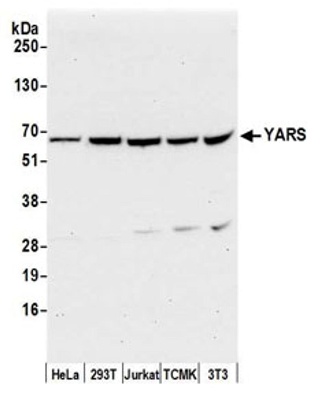 Detection of human and mouse YARS by western blot.