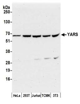 Detection of human and mouse YARS by western blot.