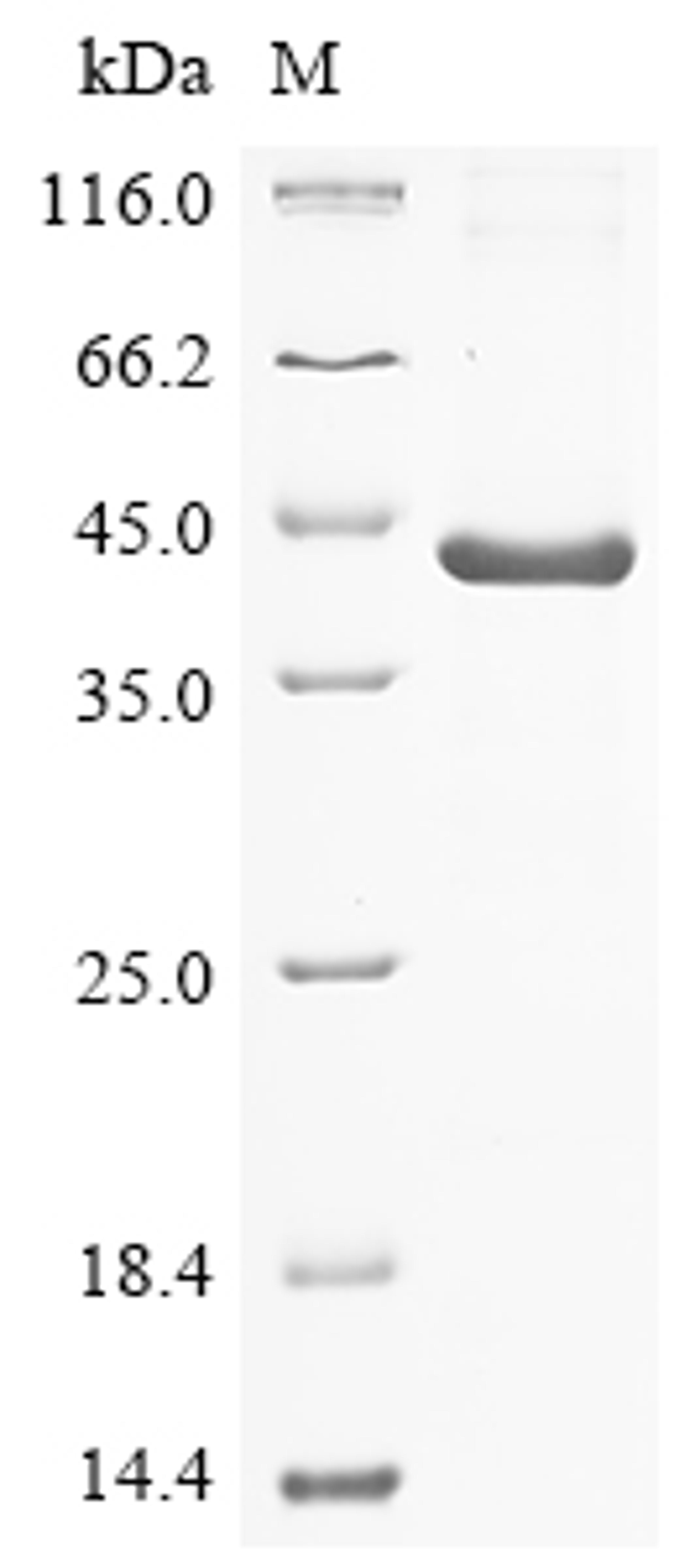 (Tris-Glycine gel) Discontinuous SDS-PAGE (reduced) with 5% enrichment gel and 15% separation gel.