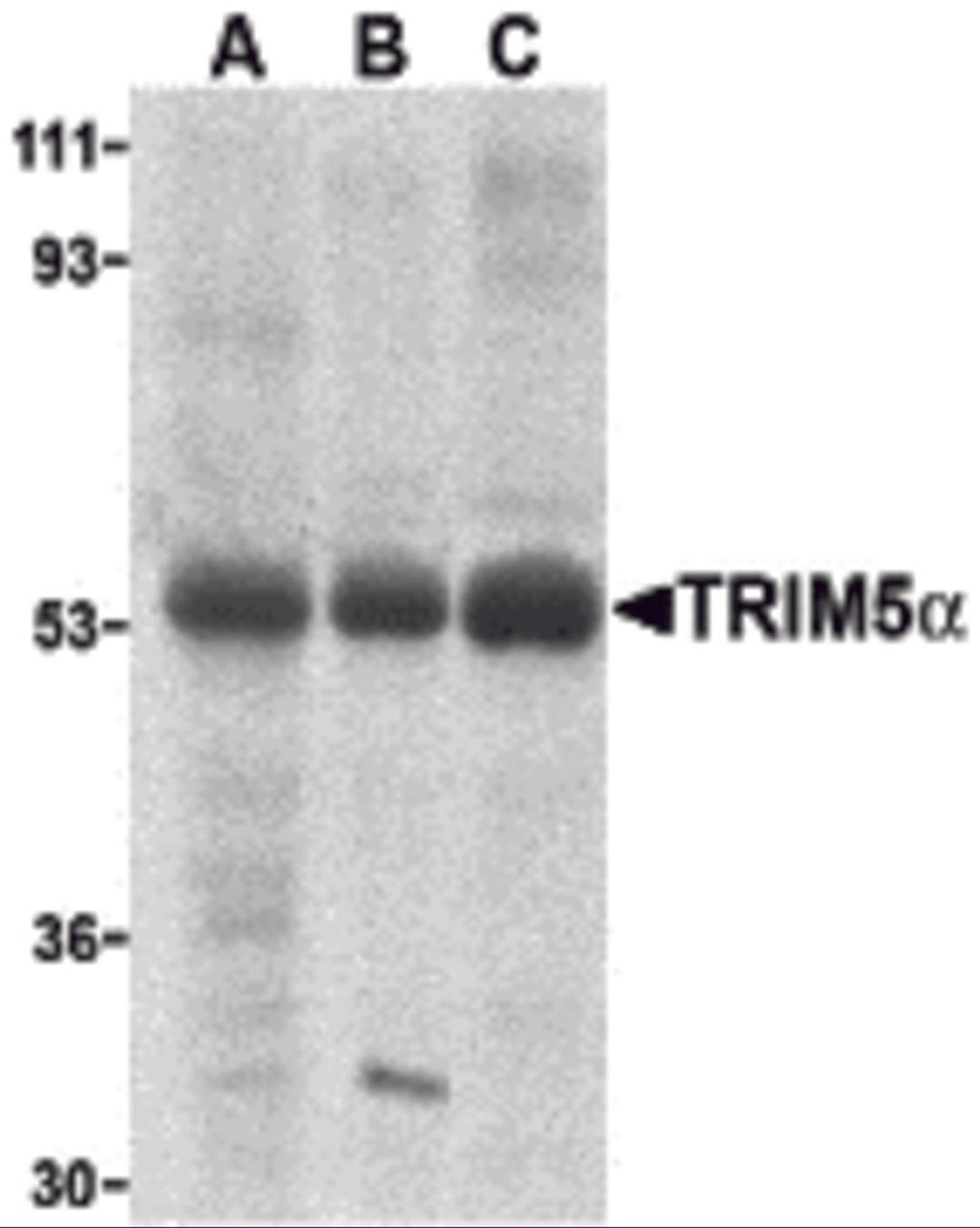 Western blot analysis of TRIM5 alpha expression in human stomach (A), thymus (B), and uterus (C) cell lysate with TRIM5 alpha antibody at 2 &#956;g /ml.