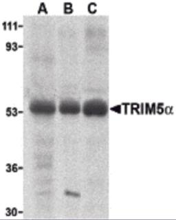 Western blot analysis of TRIM5 alpha expression in human stomach (A), thymus (B), and uterus (C) cell lysate with TRIM5 alpha antibody at 2 &#956;g /ml.