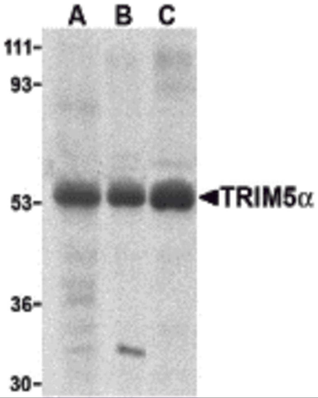 Western blot analysis of TRIM5 alpha expression in human stomach (A), thymus (B), and uterus (C) cell lysate with TRIM5 alpha antibody at 2 μg /ml.