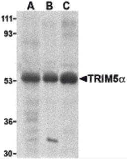Western blot analysis of TRIM5 alpha expression in human stomach (A), thymus (B), and uterus (C) cell lysate with TRIM5 alpha antibody at 2 μg /ml.