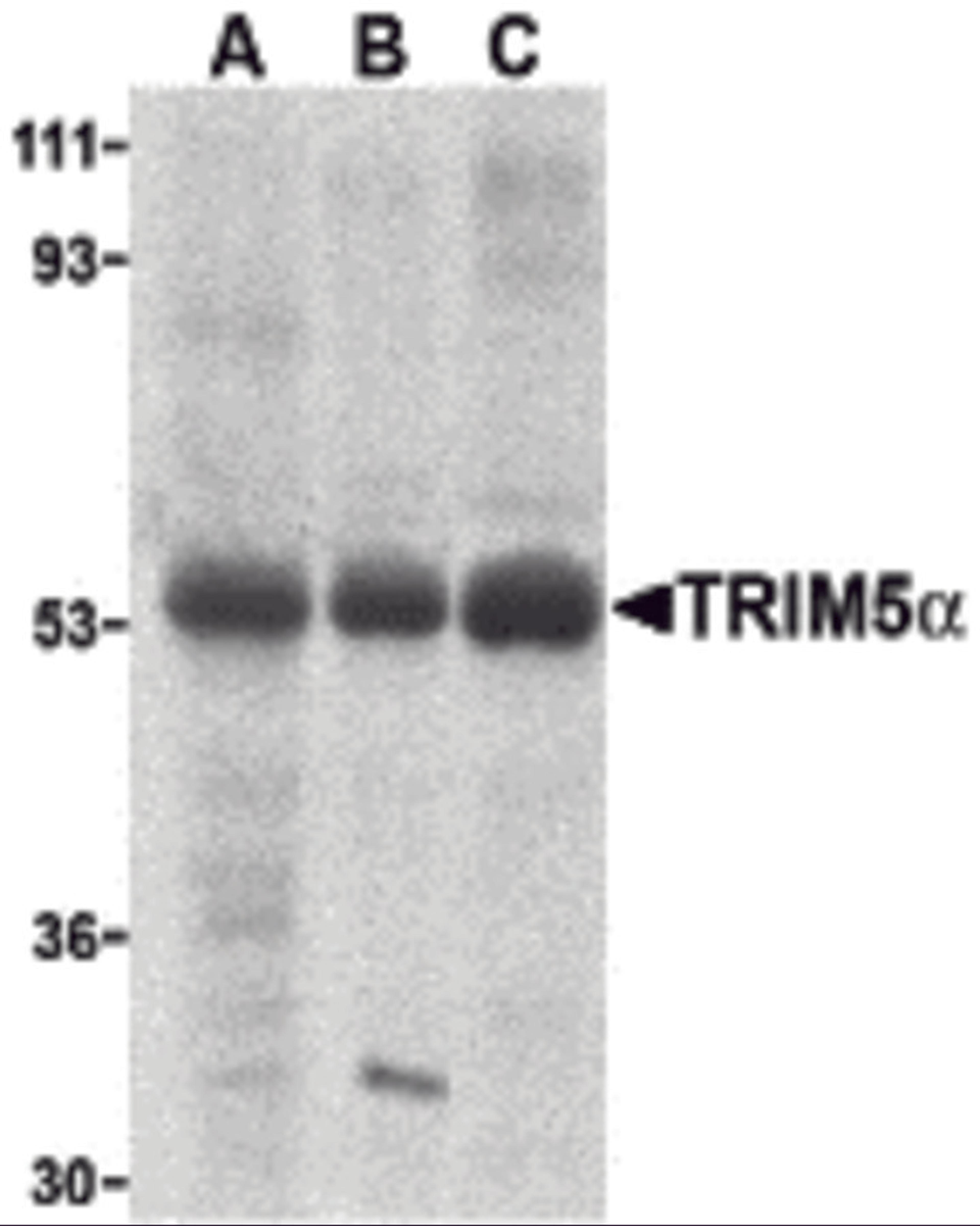 Western blot analysis of TRIM5 alpha expression in human stomach (A), thymus (B), and uterus (C) cell lysate with TRIM5 alpha antibody at 2 μg /ml.