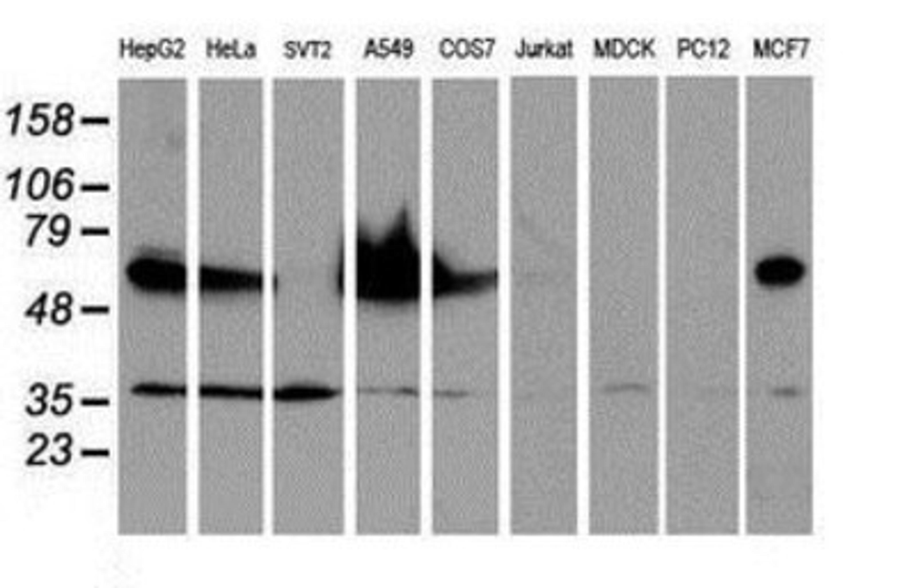 Western Blot: Epsin-2 Antibody (1G3) [NBP2-01775] Analysis of extracts (35ug) from 9 different cell lines by using anti-Epsin-2 monoclonal antibody.