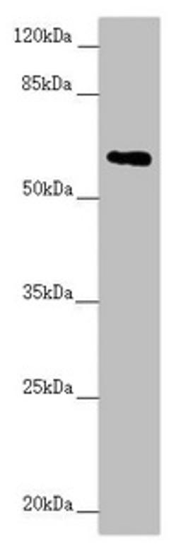 Western blot. All lanes: TRIM23 antibody at 2.67 ug/ml + Raw264.7 whole cell lysate. Secondary. Goat polyclonal to rabbit IgG at 1/10000 dilution. Predicted band size: 65, 64, 62 kDa. Observed band size: 65 kDa.