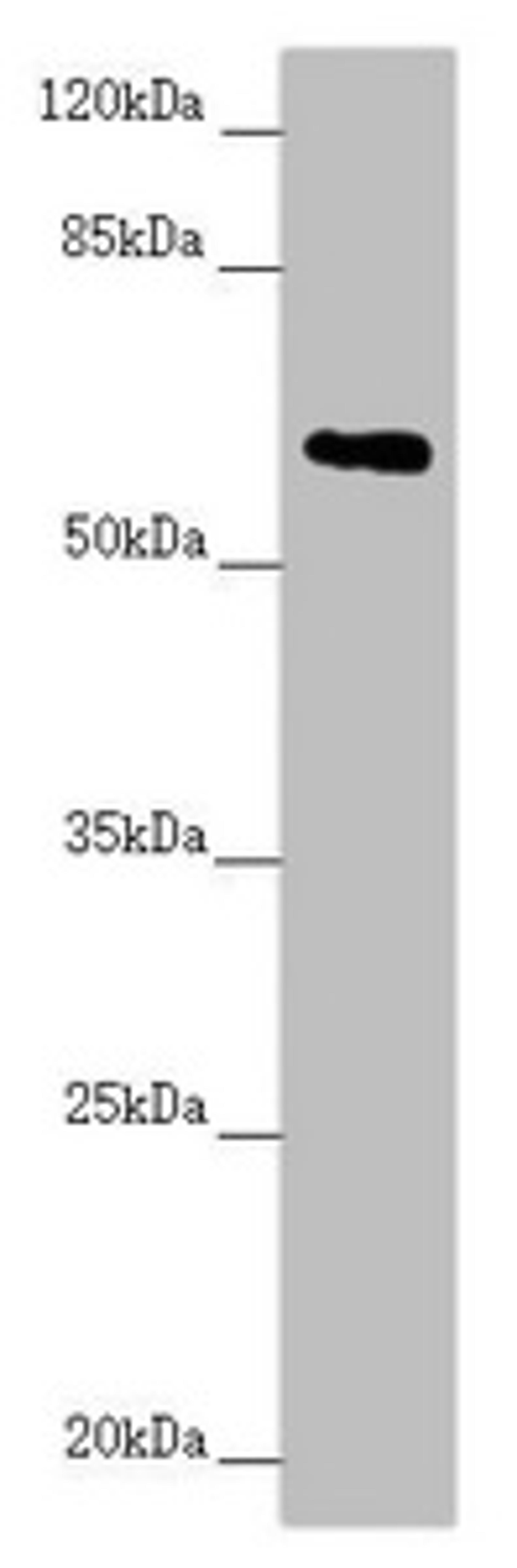 Western blot. All lanes: TRIM23 antibody at 2.67 ug/ml + Raw264.7 whole cell lysate. Secondary. Goat polyclonal to rabbit IgG at 1/10000 dilution. Predicted band size: 65, 64, 62 kDa. Observed band size: 65 kDa.