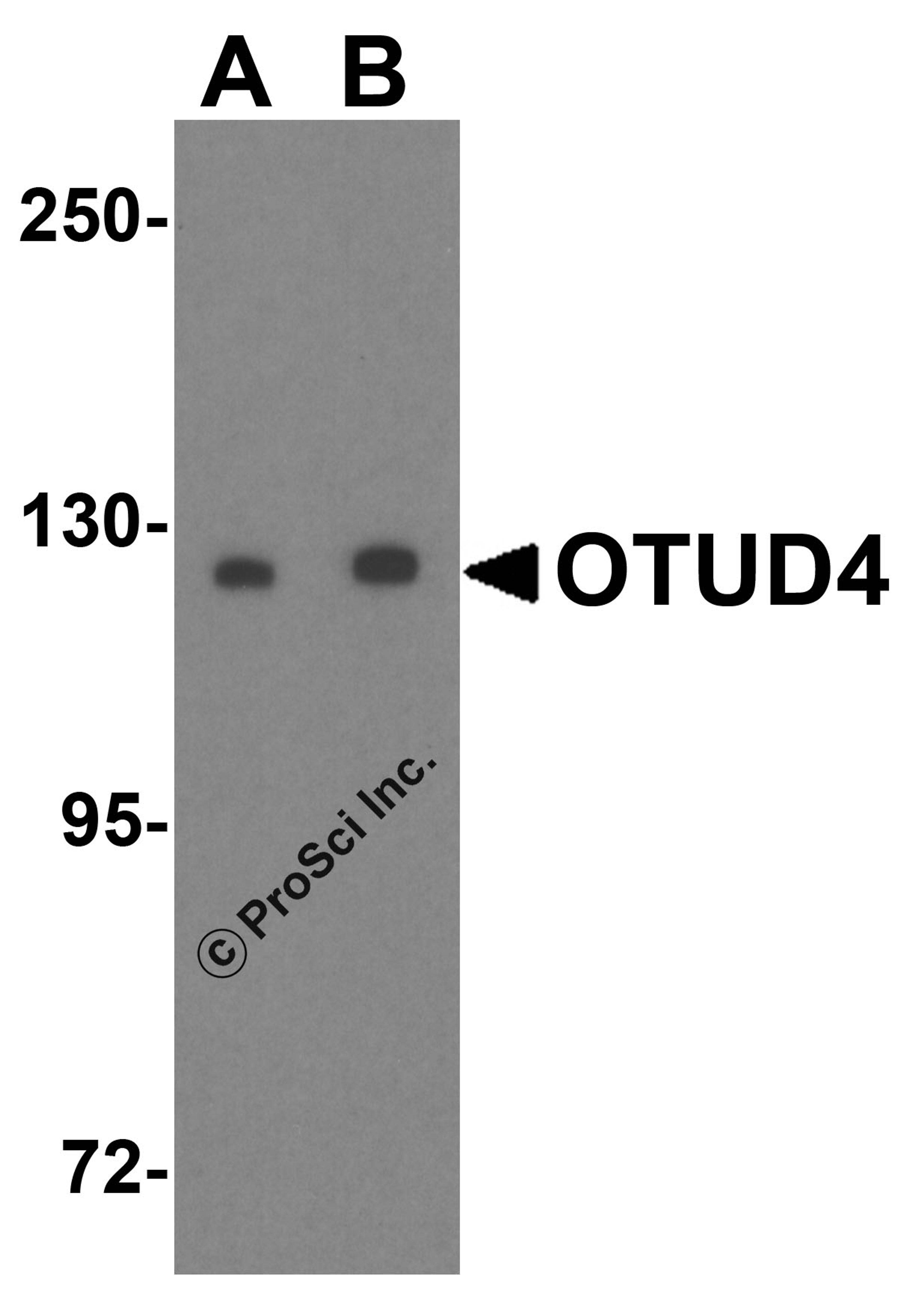 Western blot analysis of OTUD4 in Daudi cell lysate with OTUD4 antibody at (A) 0.25 and (B) 0.5 μg/mL.