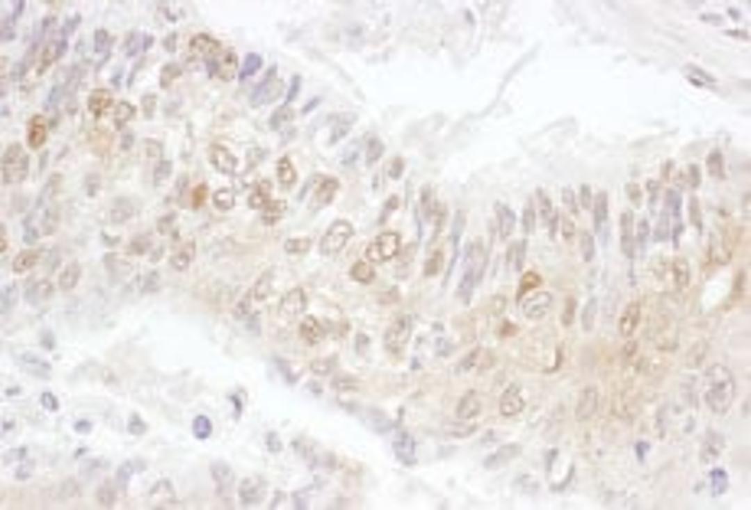 Detection of human CDK4 by immunohistochemistry.