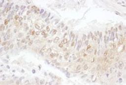 Detection of human CDK4 by immunohistochemistry.