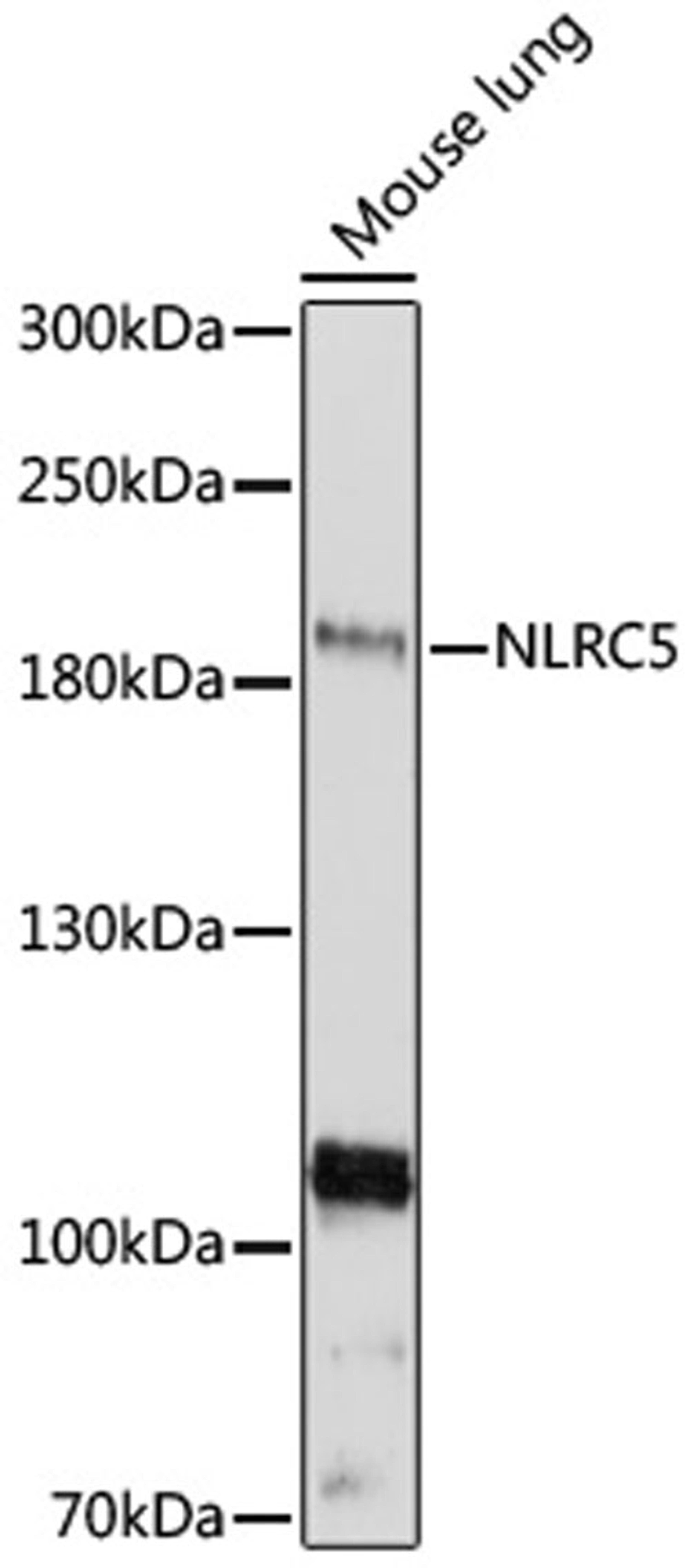 Western blot - NLRC5 antibody (A16740)