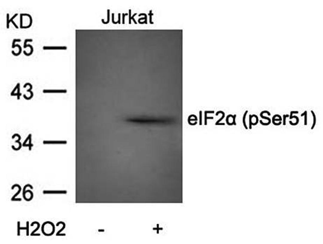 Western blot analysis of eIF2a(Phospho-Ser51) antibody in Jurkat cells lysates