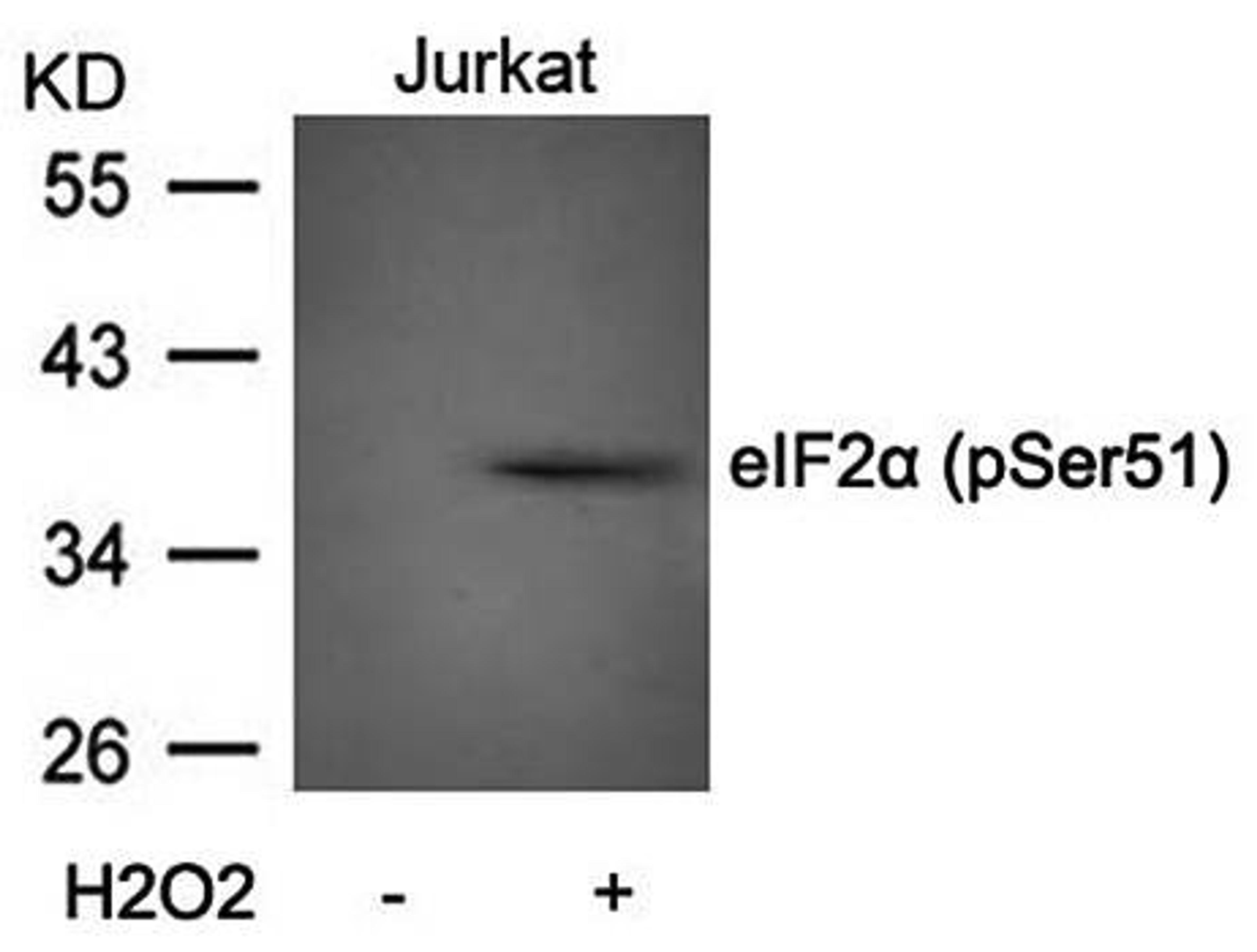 Western blot analysis of eIF2a(Phospho-Ser51) antibody in Jurkat cells lysates