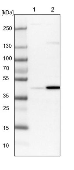 Western Blot: RTCD1 Antibody [NBP1-87113] - Lane 1: NIH-3T3 cell lysate (Mouse embryonic fibroblast cells)<br/>Lane 2: NBT-II cell lysate (Rat Wistar bladder tumour cells)