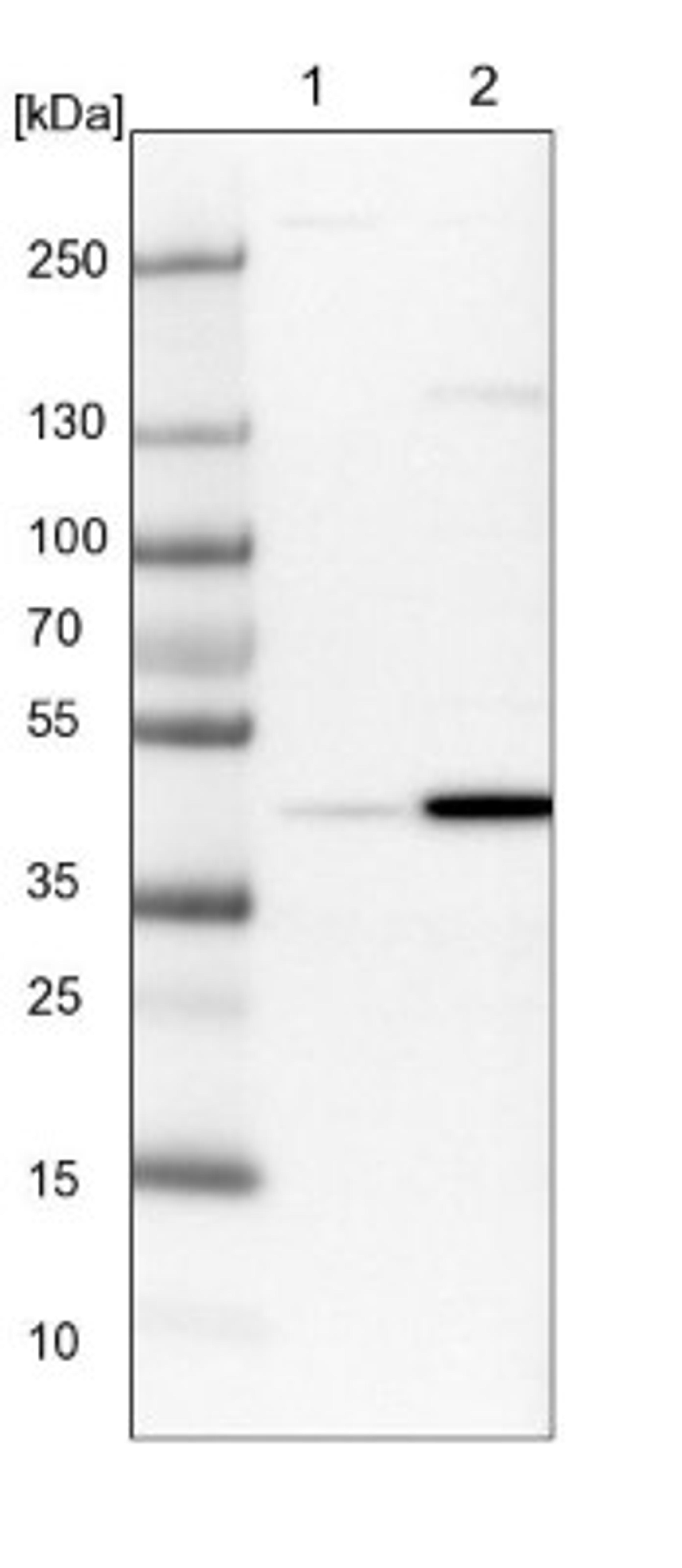 Western Blot: RTCD1 Antibody [NBP1-87113] - Lane 1: NIH-3T3 cell lysate (Mouse embryonic fibroblast cells)<br/>Lane 2: NBT-II cell lysate (Rat Wistar bladder tumour cells)