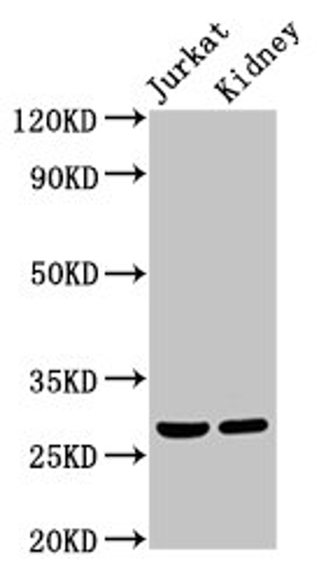 Western Blot. Positive WB detected in: Jurkat whole cell lysate, Rat kidney tissue. All lanes: MSX2 antibody at 2µg/ml. Secondary. Goat polyclonal to rabbit IgG at 1/50000 dilution. Predicted band size: 29 kDa. Observed band size: 29 kDa