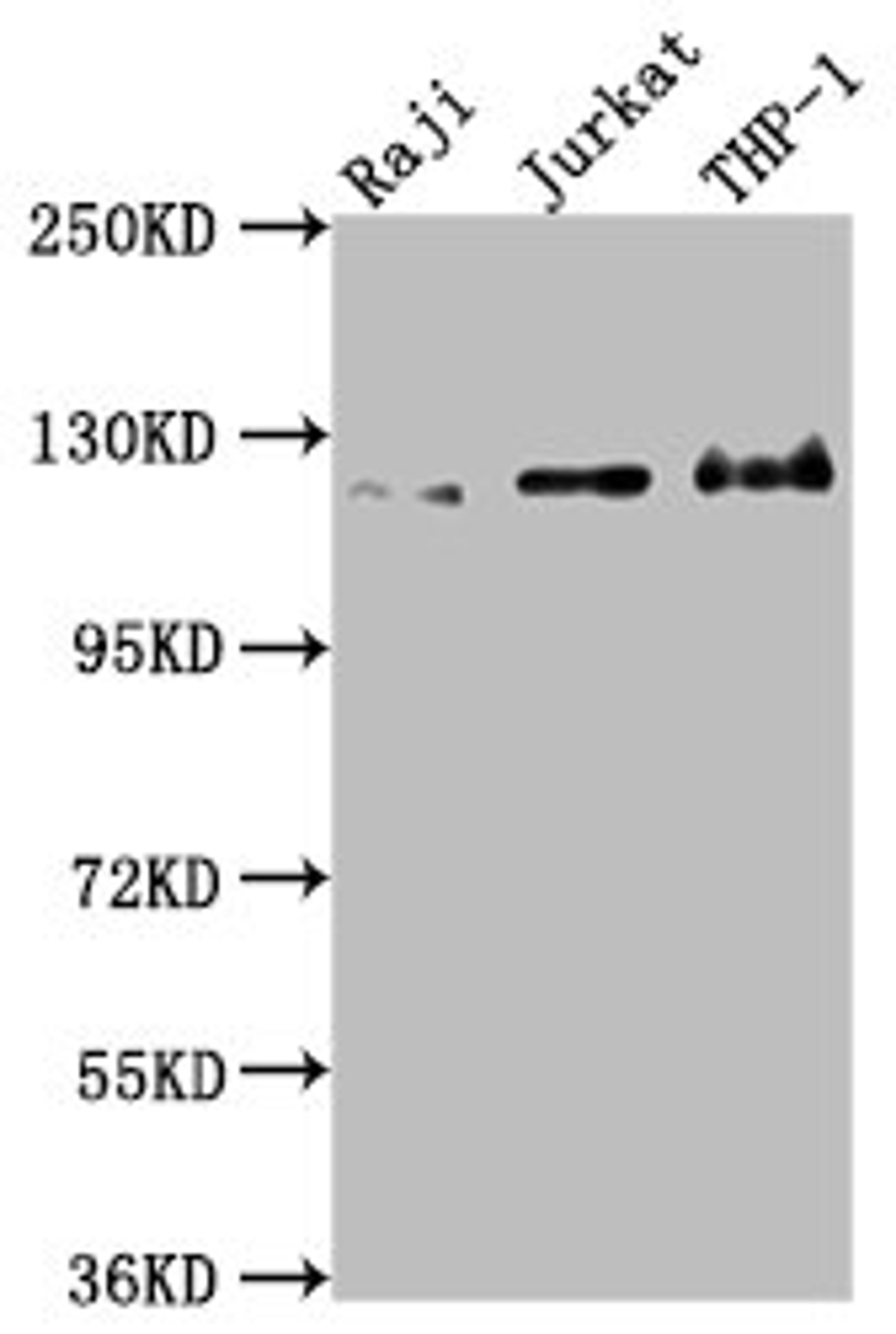 Western Blot. Positive WB detected in: Raji whole cell lysate, Jurkat whole cell lysate, THP-1 whole cell lysate. All lanes: MICAL1 antibody at 1:2000. Secondary. Goat polyclonal to rabbit IgG at 1/50000 dilution. Predicted band size: 118, 109, 38, 120 kDa. Observed band size: 120 kDa.