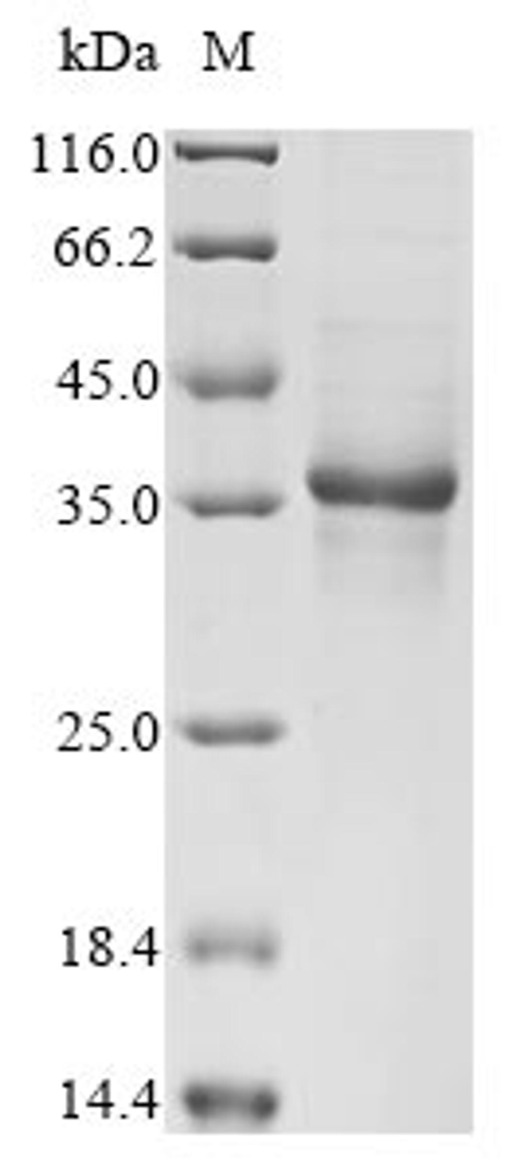 (Tris-Glycine gel) Discontinuous SDS-PAGE (reduced) with 5% enrichment gel and 15% separation gel.