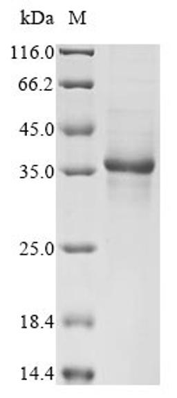 (Tris-Glycine gel) Discontinuous SDS-PAGE (reduced) with 5% enrichment gel and 15% separation gel.
