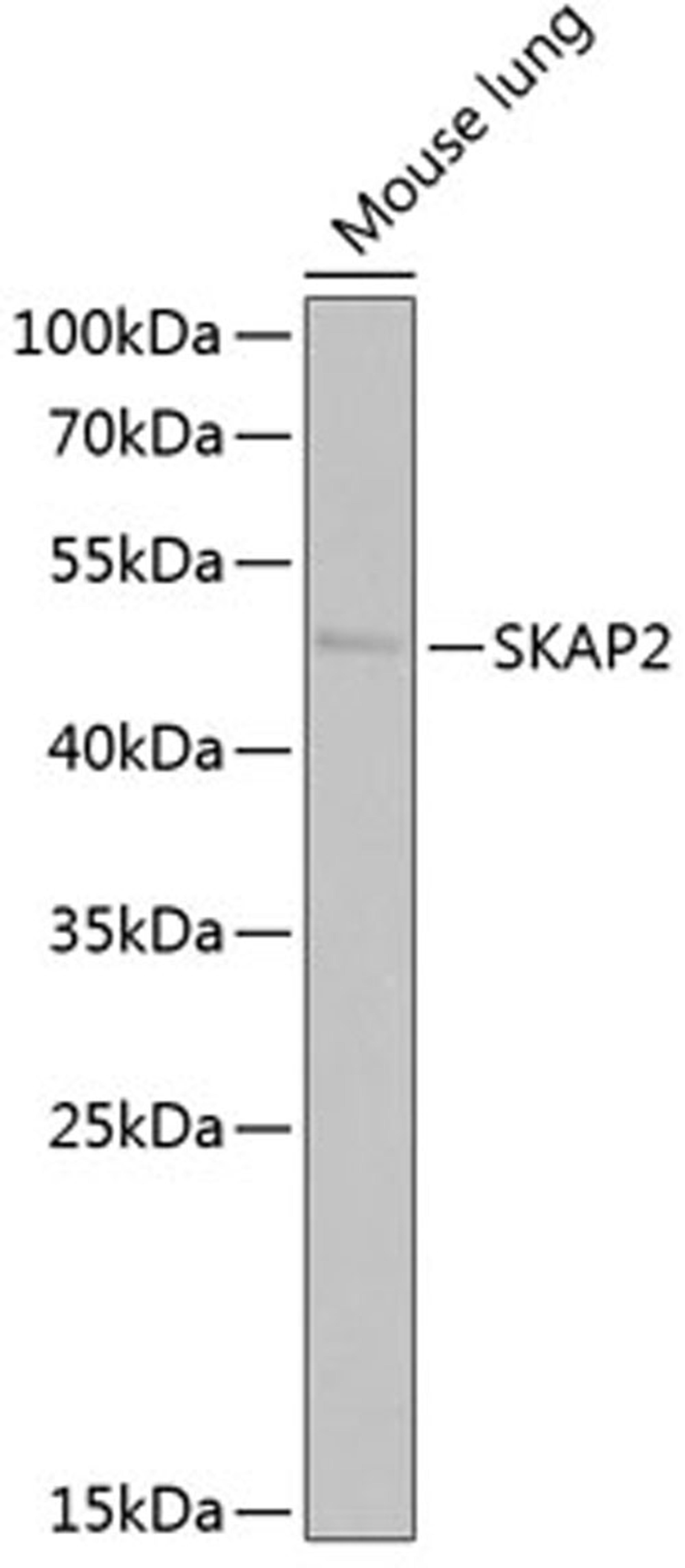 Western blot - SKAP2 antibody (A6435)