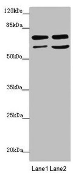 Western blot. All lanes: VPS33B antibody at 2.72µg/ml. Lane 1: Hela whole cell lysate. Lane 2: A549 whole cell lysate. Secondary. Goat polyclonal to rabbit IgG at 1/10000 dilution. Predicted band size: 71, 61 kDa. Observed band size: 71, 61 kDa