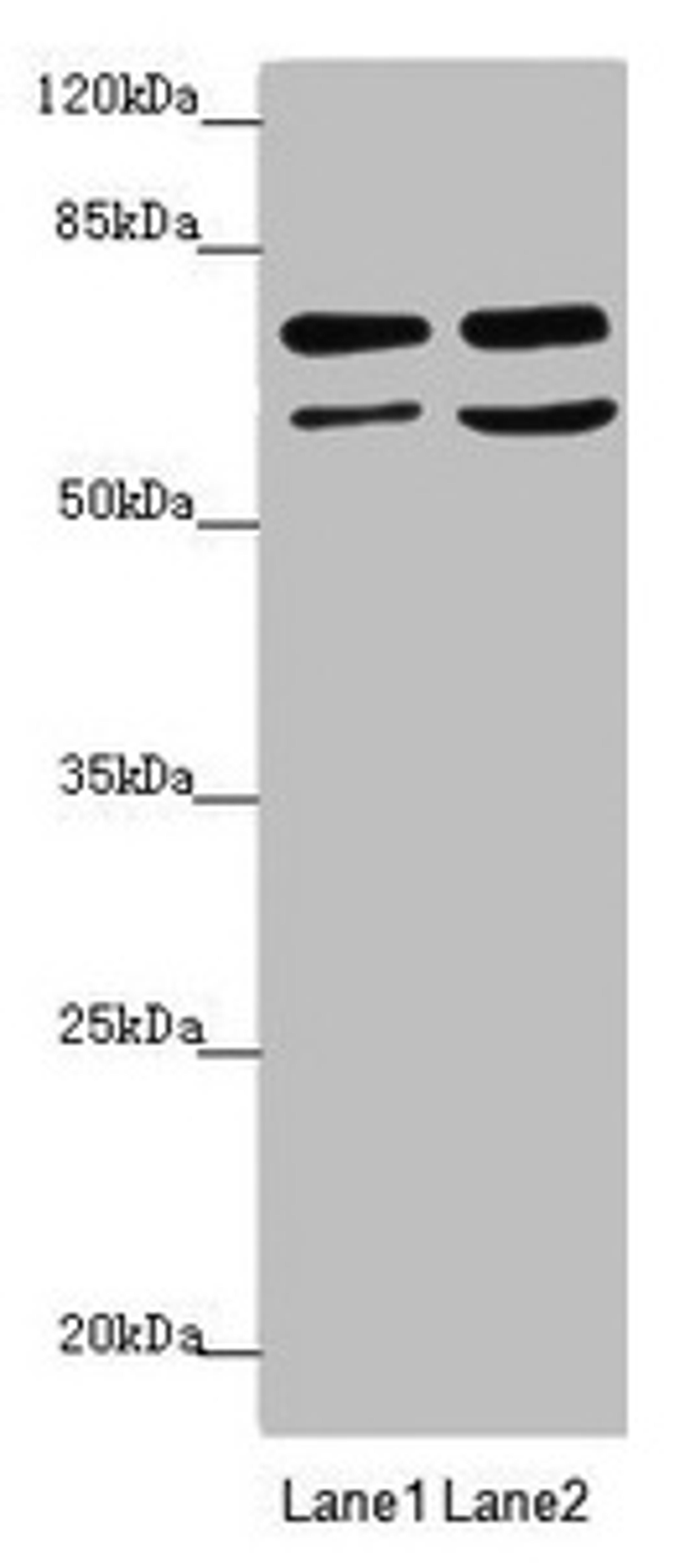 Western blot. All lanes: VPS33B antibody at 2.72µg/ml. Lane 1: Hela whole cell lysate. Lane 2: A549 whole cell lysate. Secondary. Goat polyclonal to rabbit IgG at 1/10000 dilution. Predicted band size: 71, 61 kDa. Observed band size: 71, 61 kDa