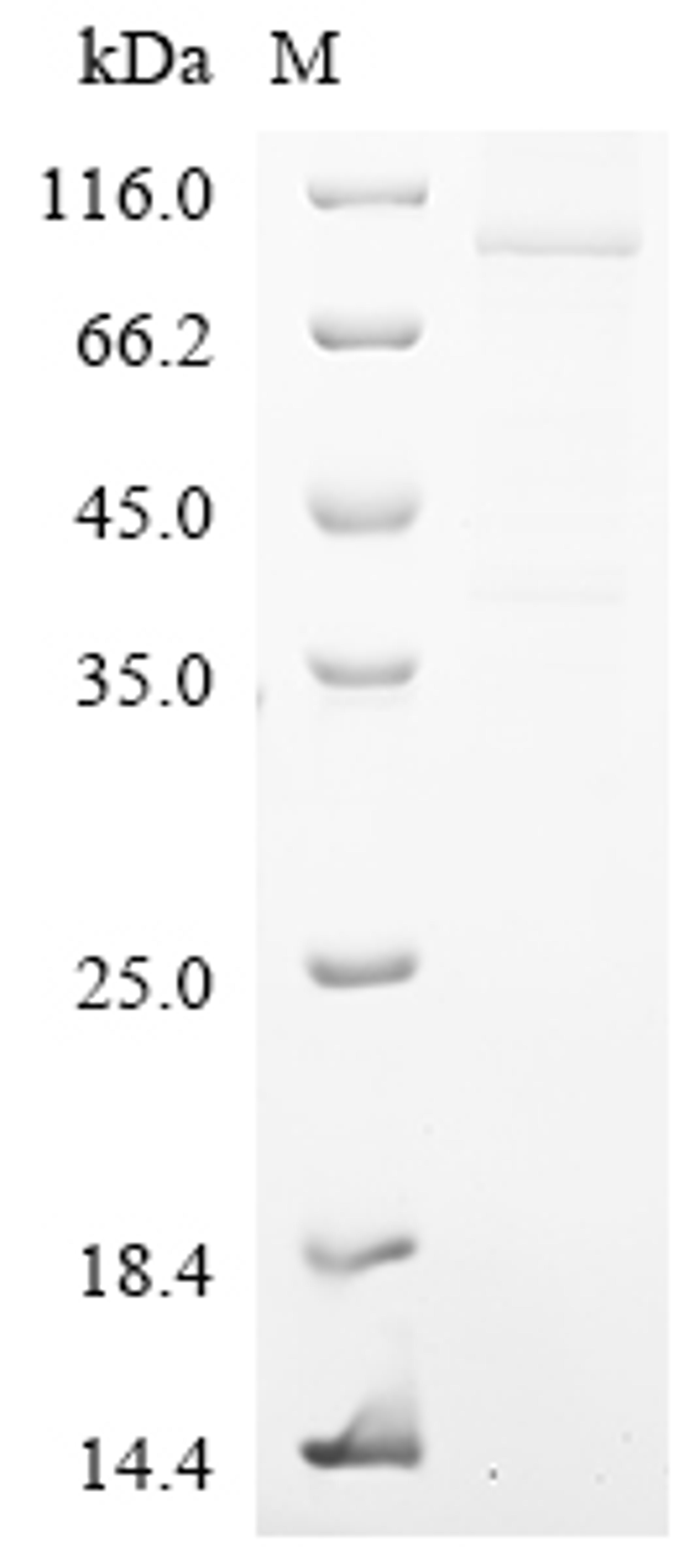 (Tris-Glycine gel) Discontinuous SDS-PAGE (reduced) with 5% enrichment gel and 15% separation gel.