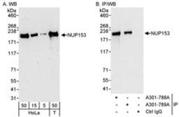 Detection of human NUP153 by western blot and immunoprecipitation.