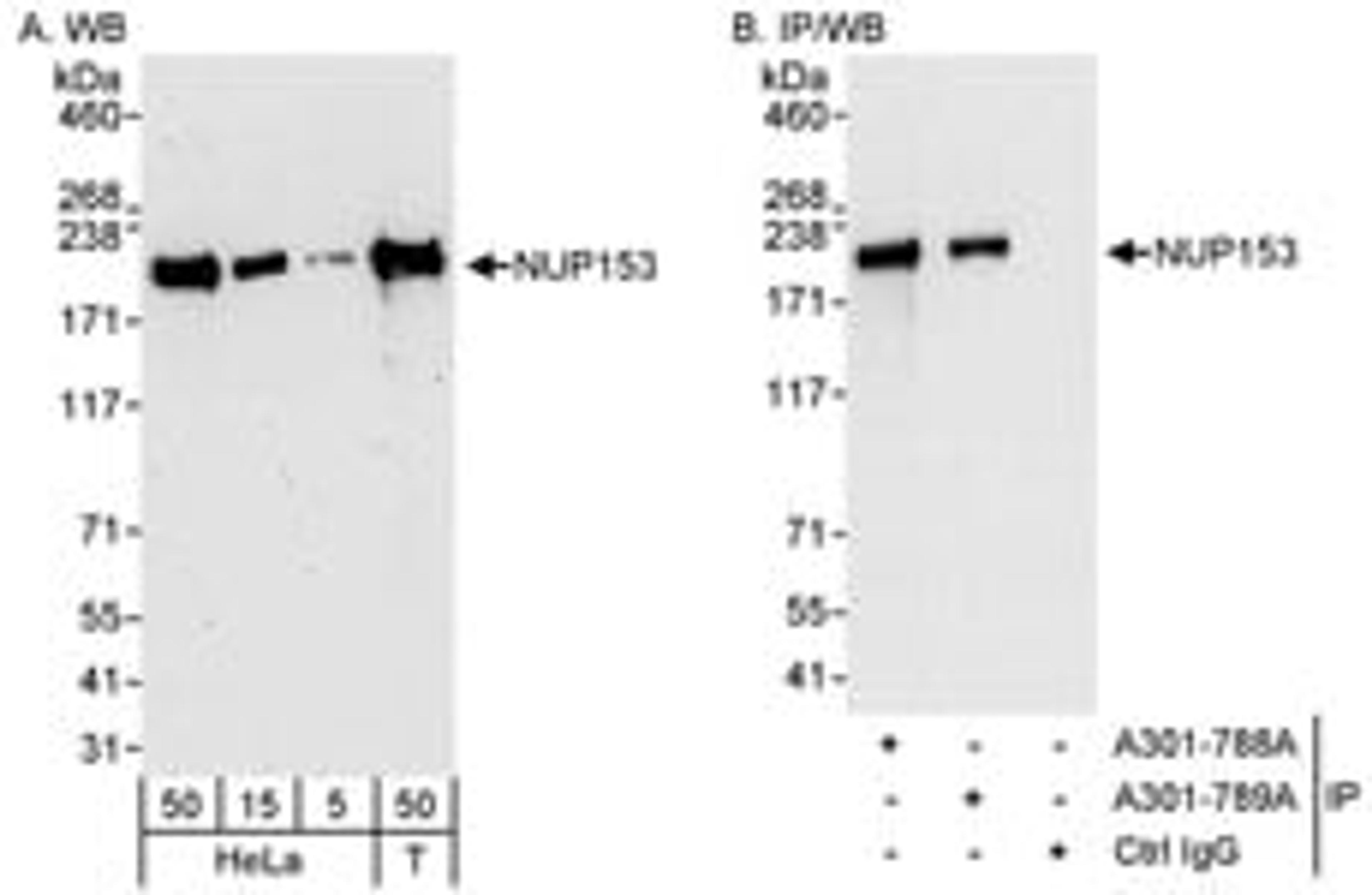 Detection of human NUP153 by western blot and immunoprecipitation.