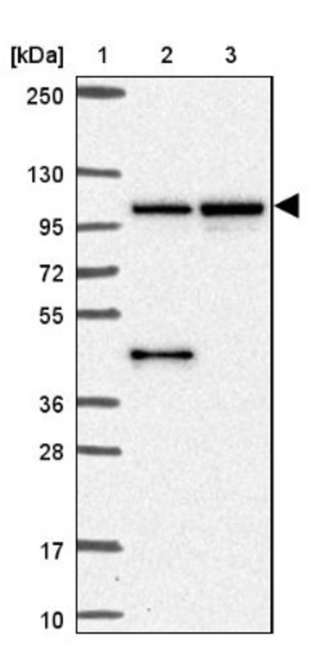 Western Blot: MMS19 like protein Antibody [NBP2-47371] - Lane 1: Marker [kDa] 250, 130, 95, 72, 55, 36, 28, 17, 10.  Lane 2: Human cell line RT-4.  Lane 3: Human cell line U-251MG.