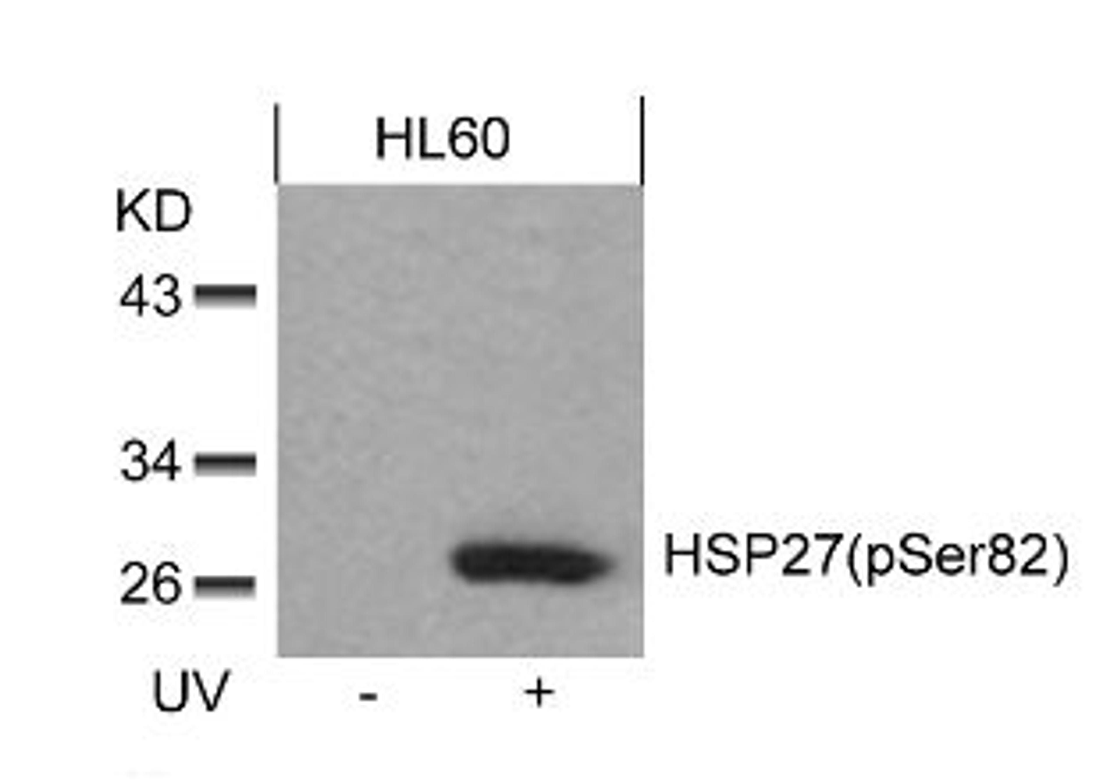 Western blot analysis of lysed extracts from HL60 cells untreated or treated with UV using HSP27 (Phospho-Ser82).